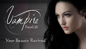 Vampire Facelift: your beauty Revived